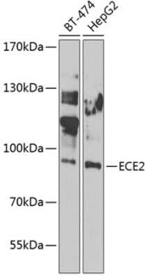 Western Blot: ECE-2 AntibodyBSA Free [NBP3-05677]